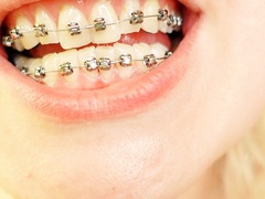 braces mouth tour video - vore fetish